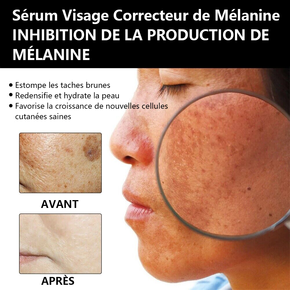 ✨Sérum Correcteur des Taches Brunes – NESLEMY™ Sérum Visage Anti-Mélanine