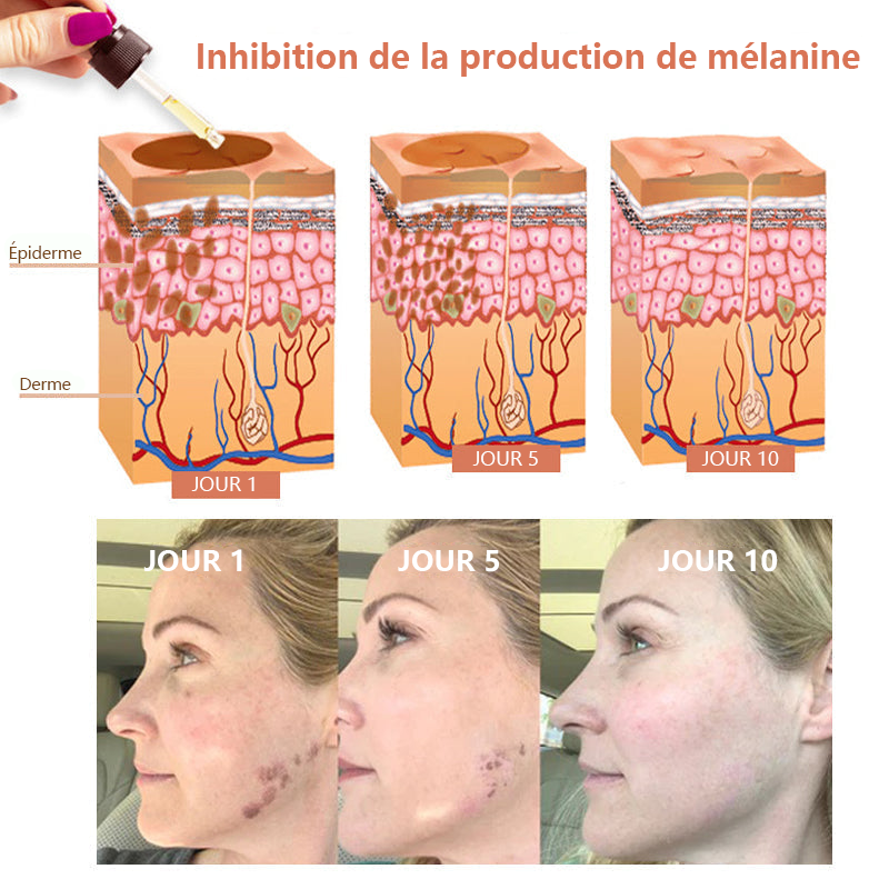 ✨Sérum Correcteur des Taches Brunes – NESLEMY™ Sérum Visage Anti-Mélanine