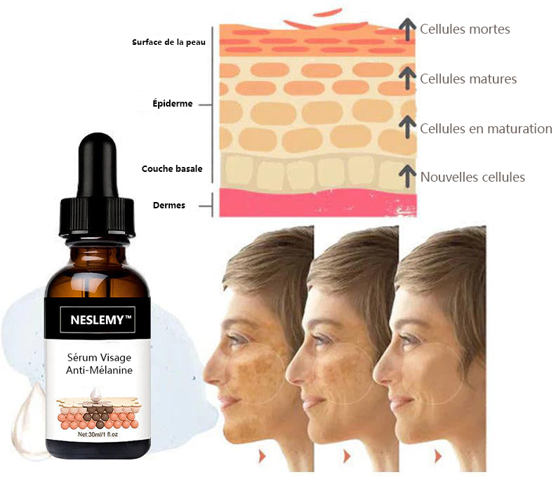 ✨Sérum Correcteur des Taches Brunes – NESLEMY™ Sérum Visage Anti-Mélanine