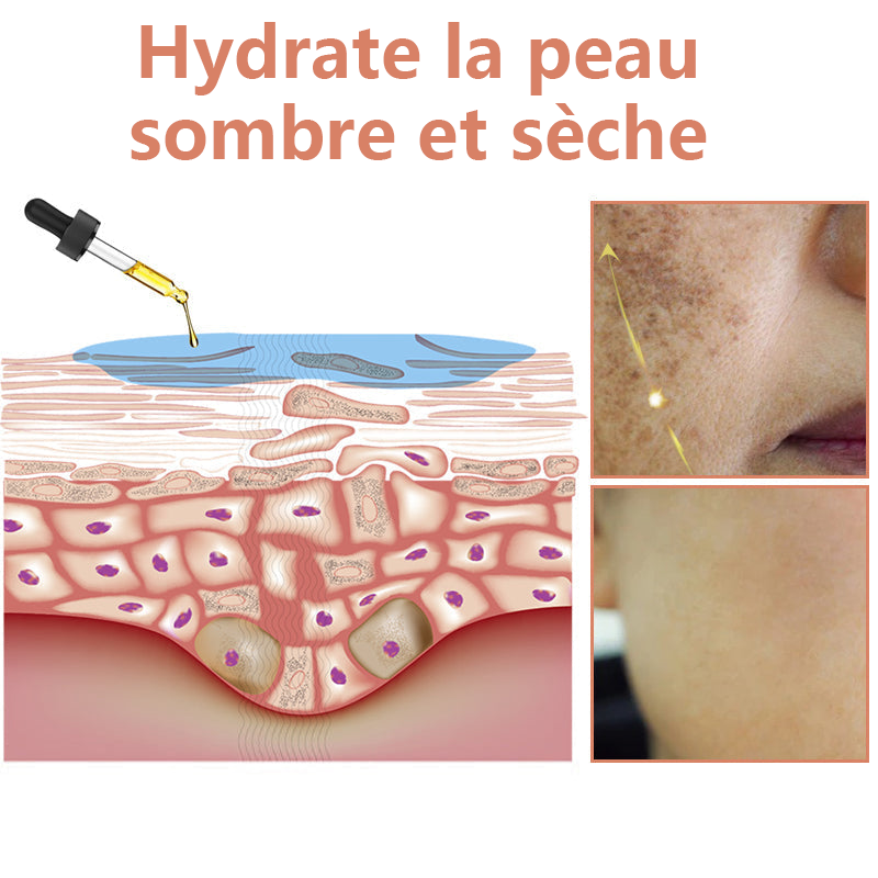 ✨Sérum Correcteur des Taches Brunes – NESLEMY™ Sérum Visage Anti-Mélanine