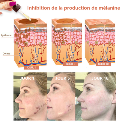 ✨Sérum Correcteur des Taches Brunes – NESLEMY™ Sérum Visage Anti-Mélanine