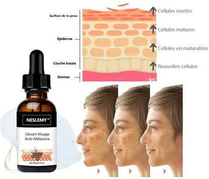 ✨Sérum Correcteur des Taches Brunes – NESLEMY™ Sérum Visage Anti-Mélanine