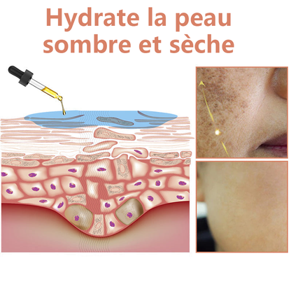 ✨Sérum Correcteur des Taches Brunes – NESLEMY™ Sérum Visage Anti-Mélanine